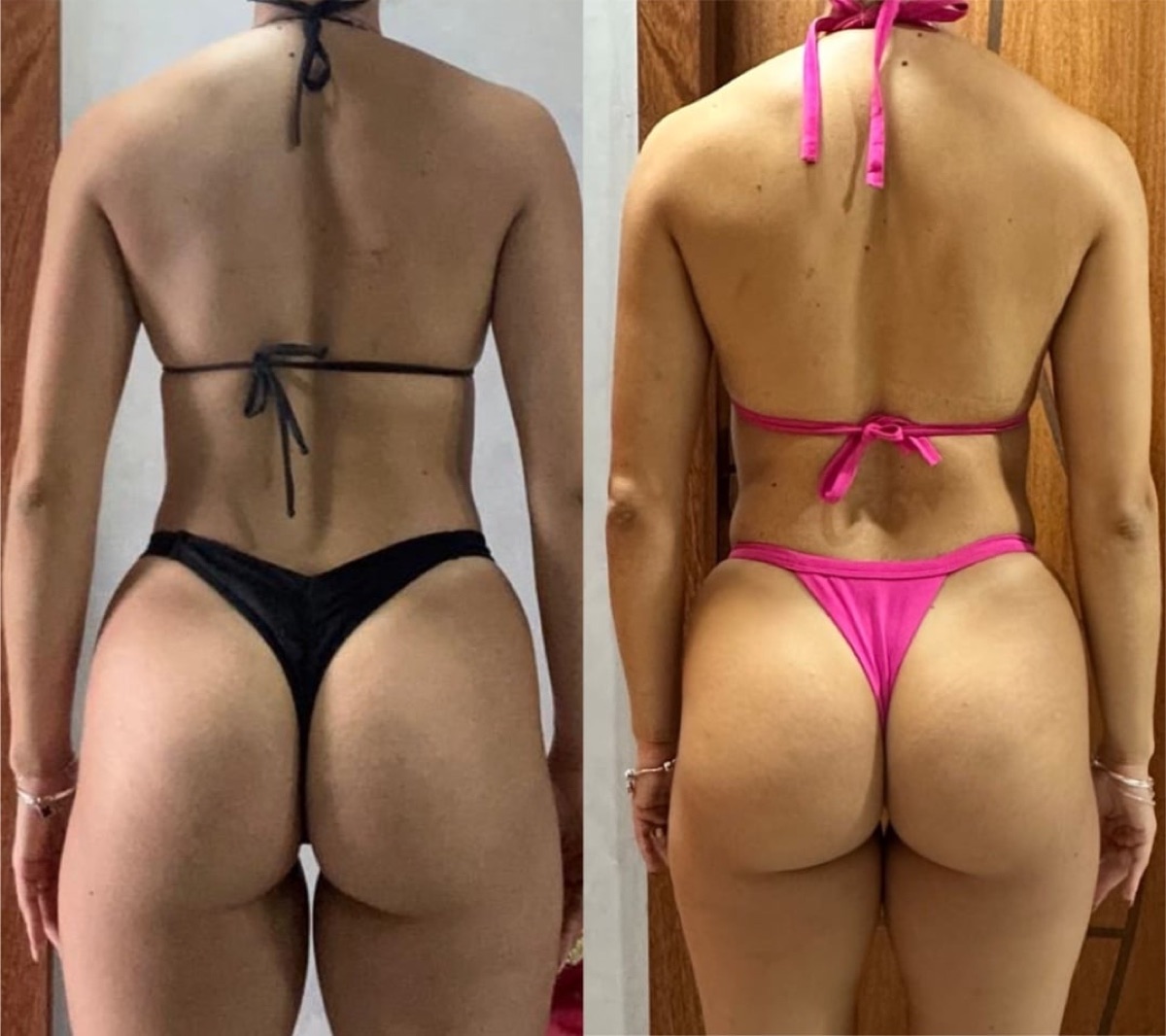 Antes e depois de aluna, de costas: à direita, glúteo mais volumoso e arredondado.